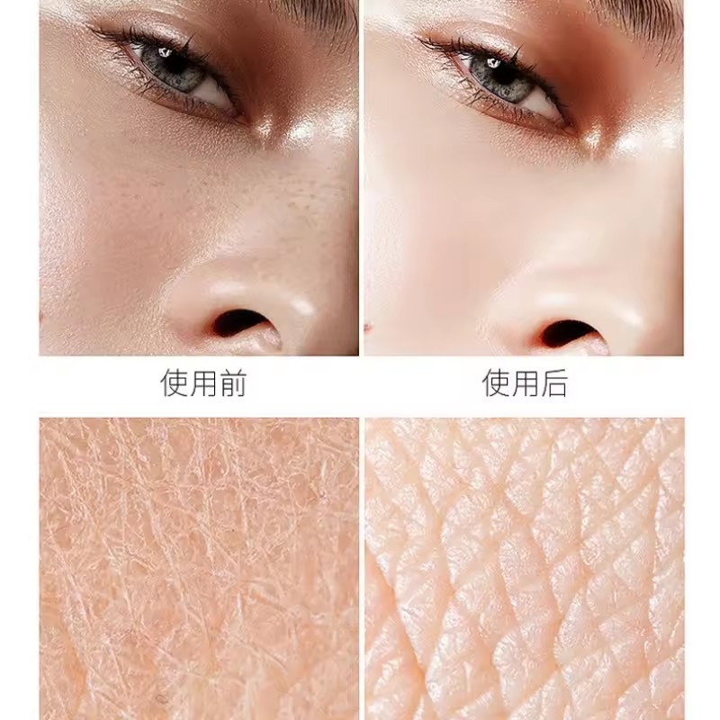 Hyaluronic Acid Niacinamide Es - огляд і ціна Niacinamide Pore Shrinking Essence
