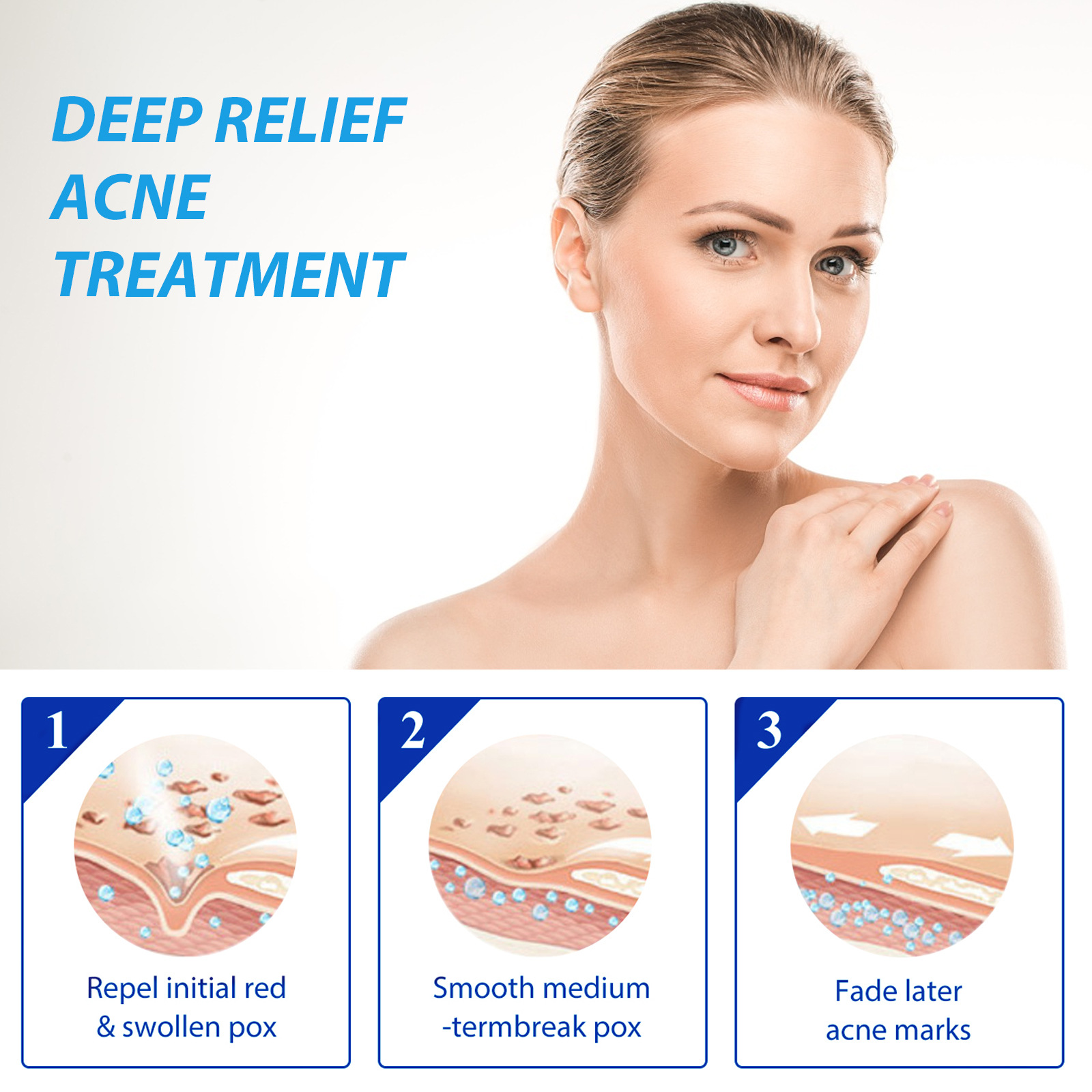 EELHOE Acne Treatment Lotion S - огляд і ціна Salicylic Acid Blackhead Remover