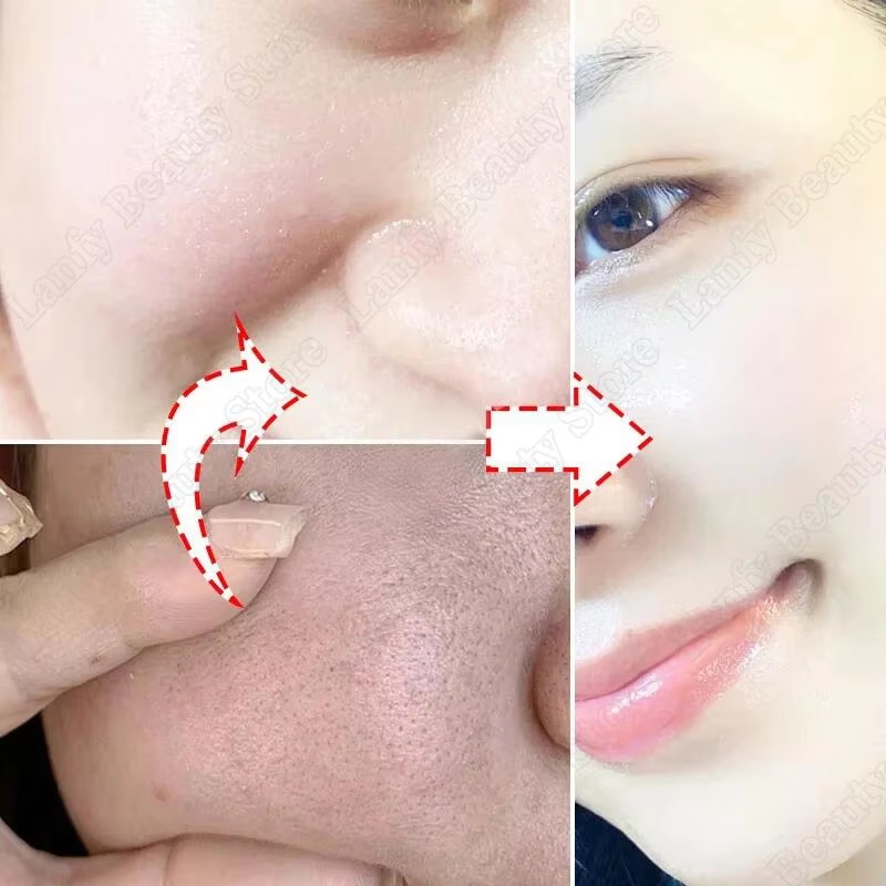 Salicylic Acid Pore Clearing C - огляд і ціна Salicylic Acid Blackhead Remover